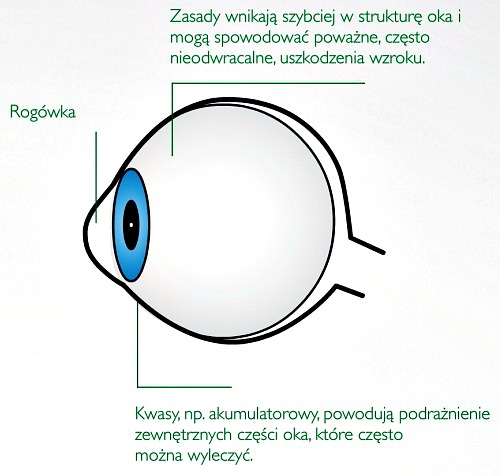 Uszkodzenia oczu Uszkodzenia oczu